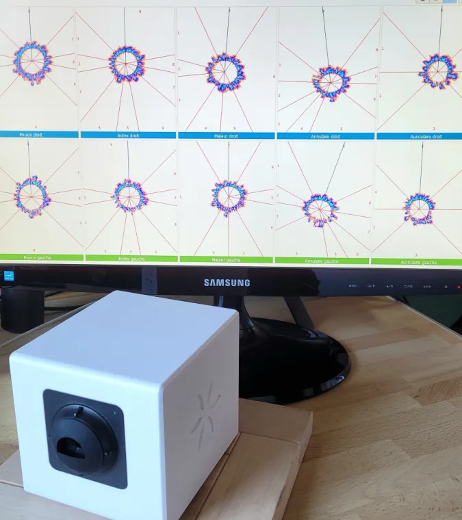 caméra GDV, Yuluka, Toulouse